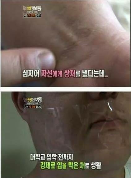 나는 틱 장애인 입니다.홍기호씨를 아십니까? 하..정말 마음이 아프다 .. | 인스티즈
