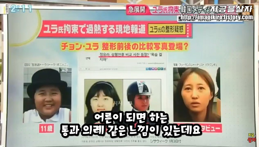 일본에서 한국인들 성형 많이한다고 낙인찍힘.jpg | 인스티즈