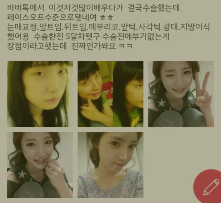 여자들 성형수술 후기.jpg | 인스티즈