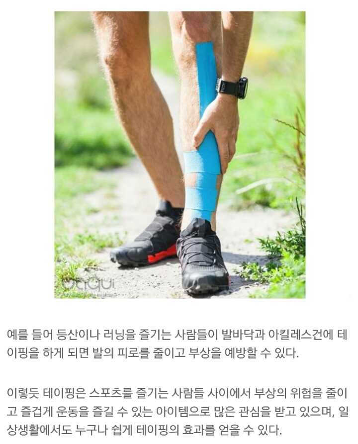 [다이어트칼럼] 알록달록 스포츠 테이핑, 왜 하는 거지? | 인스티즈