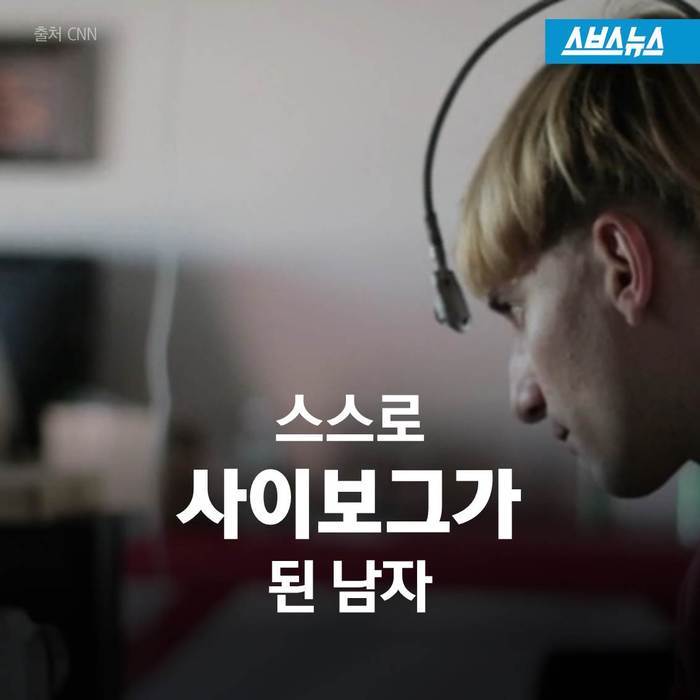  스스로 사이보그가 된 남자 | 인스티즈