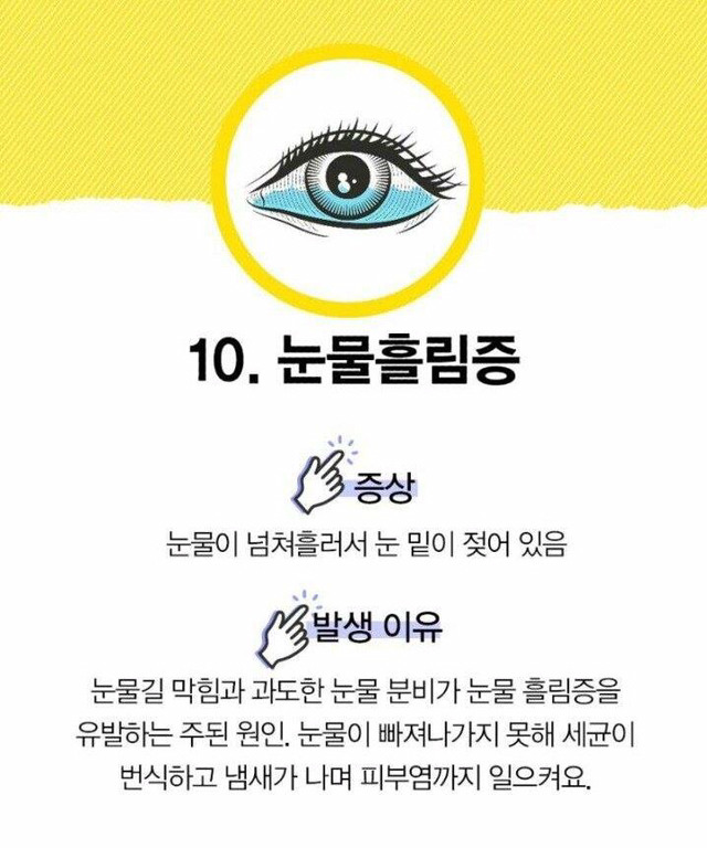 눈으로 알 수 있는 질병 | 인스티즈