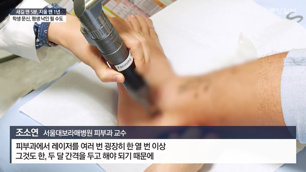 문신하고 후회하는 10대들 | 인스티즈