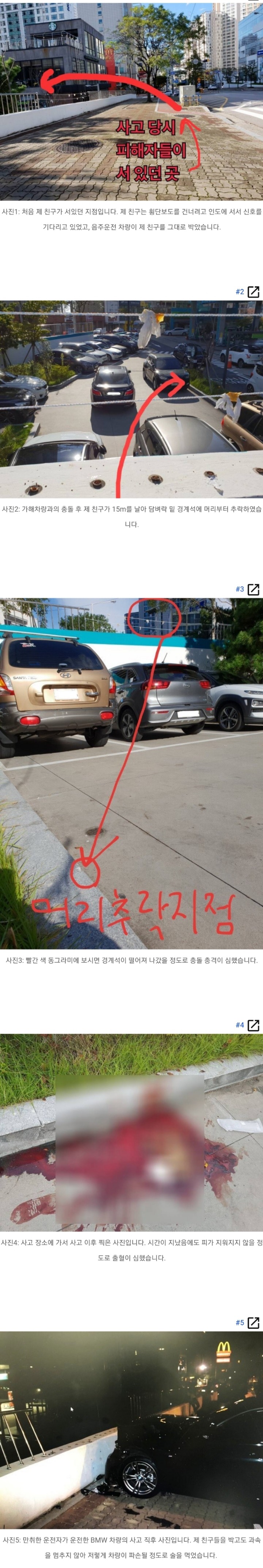 군대 휴가 중에 거의 뇌사상태 빠지게 된 고대생 (피 주의) | 인스티즈