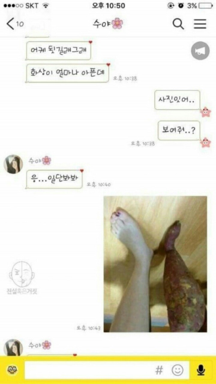 다리에 화상입은 여자친구를 본 남친의 반응 | 인스티즈