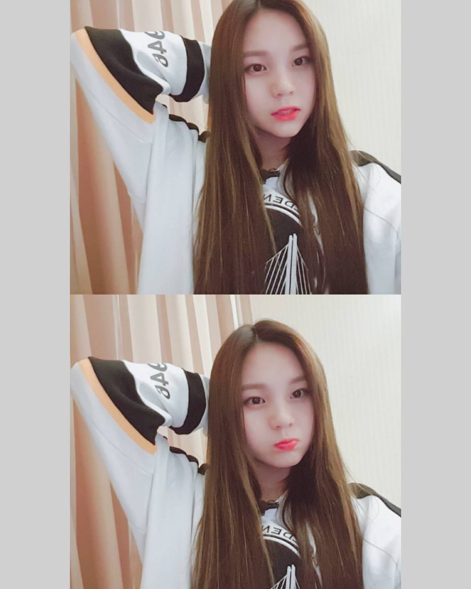 [여자친구] 전에 다친 발목이 많이 좋아져서 엄지 | 인스티즈