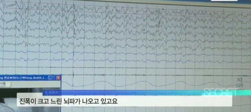잠을 못 이루어 10년째 매일 밤 소주를 마시는 50대 여성 | 인스티즈