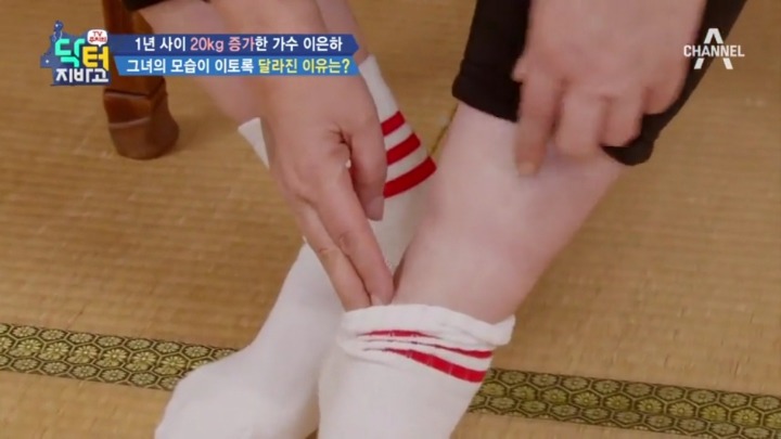 스테로이드 부작용 중 하나.jpg | 인스티즈